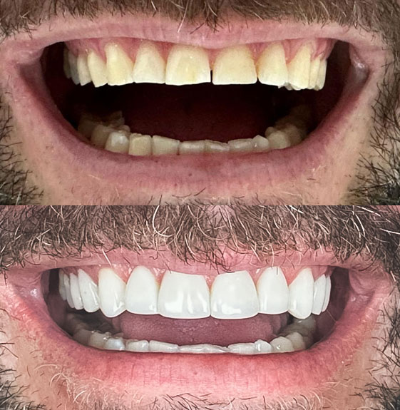 Dentista Estética Dental, no Taquaral, na Qualis Clínica de Saúde, em Campinas