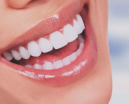 Estética Dental Taquaral, na Qualis Clínica de Saúde, em Campinas