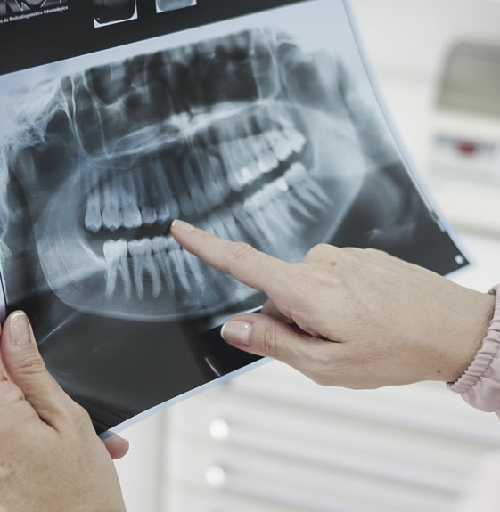 Endodontia - Taquaral, na Qualis Clínica de Saúde, em Campinas