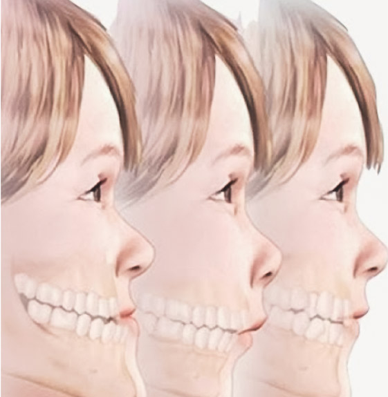 Monitoramento do Crescimento Crânio Facial - Taquaral, na Qualis Clínica de Saúde, em Campinas