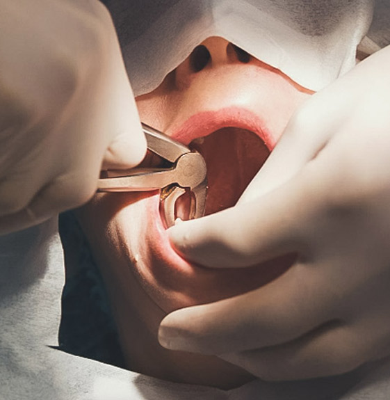 Cirurgia Geral Dental - Taquaral, na Qualis Clínica de Saúde, em Campinas